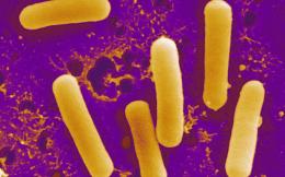 Неправилното хранене  убива полезните стомашни бактерии